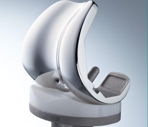 Orthoteam-Lahr-Dr.-Gemidji-Dr.-Köller103