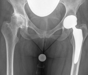 Orthoteam-Lahr-Dr.-Gemidji-Dr.-Köller104